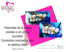 Tenemos refacciones de diferentes modelos y años, así como accesorios. 