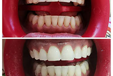 Tenemos refacciones de diferentes modelos y años, así como accesorios. 