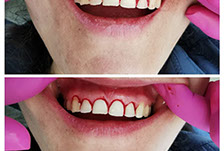 Tenemos refacciones de diferentes modelos y años, así como accesorios. 